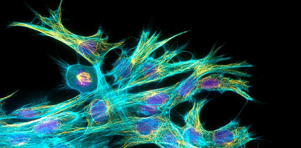 Celler med tydelig cellekjerne og cytoskjelett. Foto.