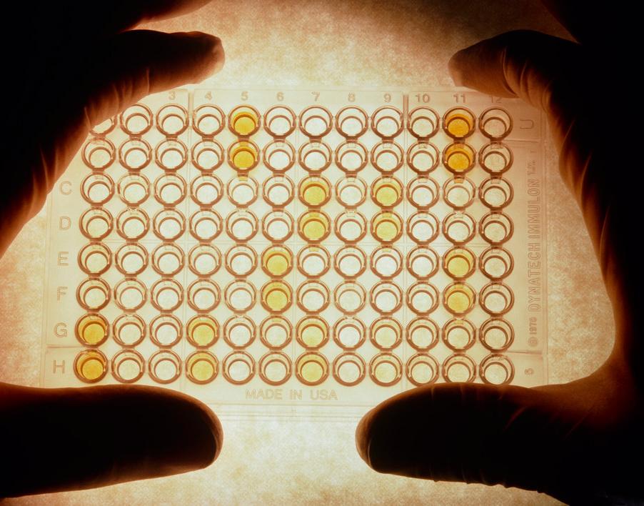 ELISA test for AIDS