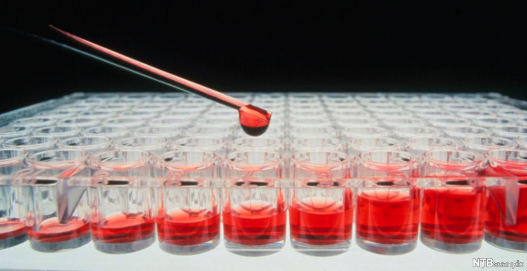 Prøvebrønner fylles med pipette. Foto.