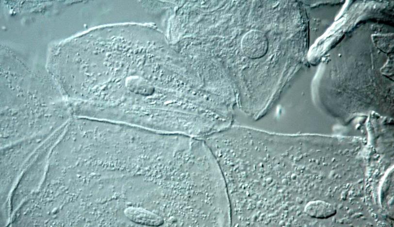 Fargeløse runde celler med tydelig kjerne og kornete cytoplasma. Mikroskopbilde.