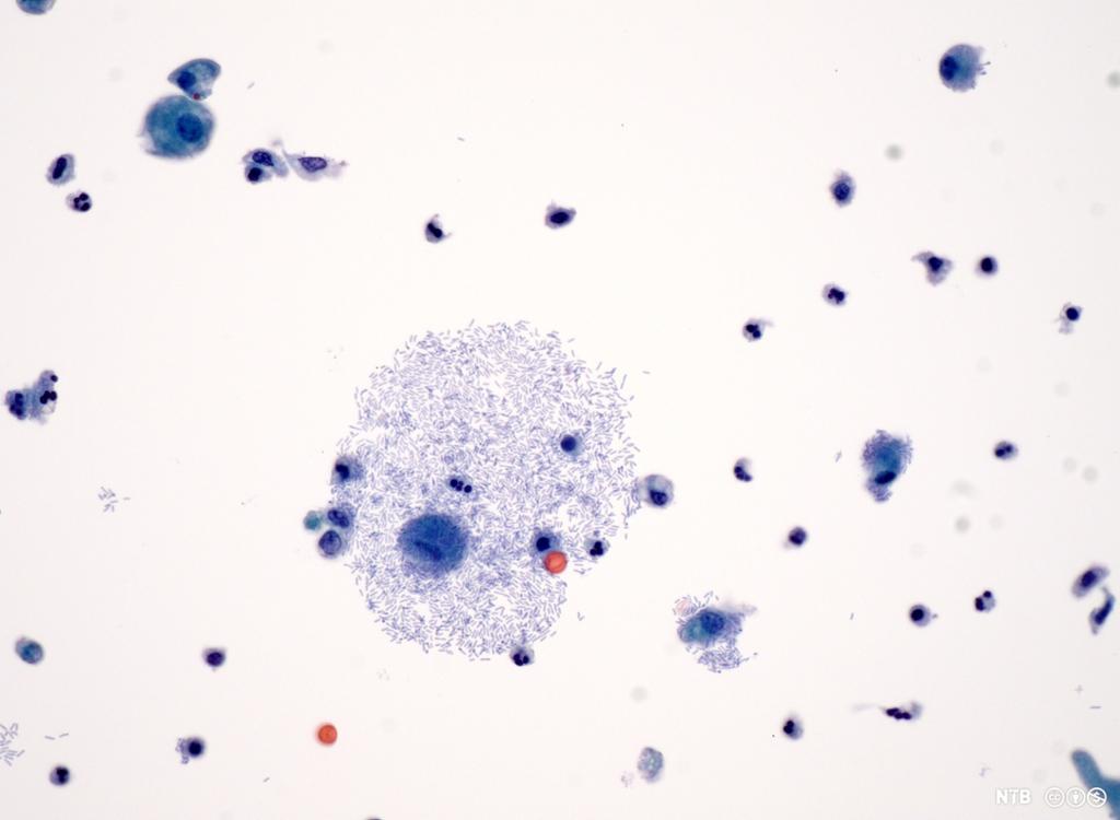 Celler med synlig cellekjerne. Noen celler skiller seg ut ved at de har en annen farge enn de fleste andre. Mikroskopfoto.