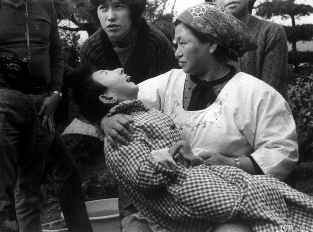 Japansk kvinne holder barn med misdannelser. Foto.