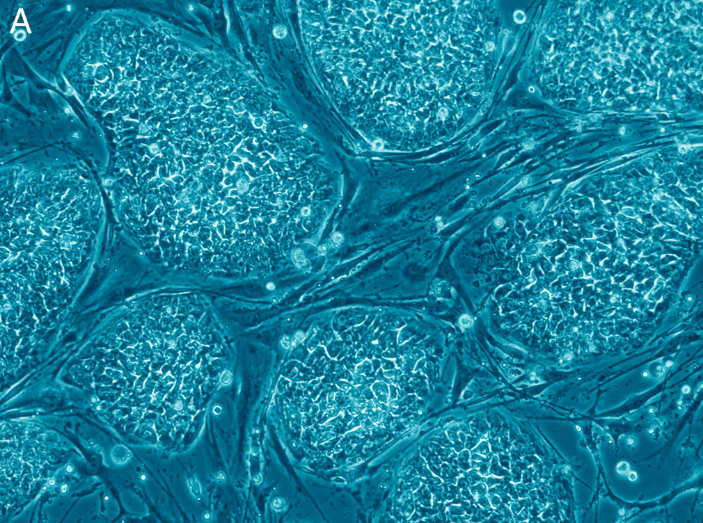 Mikroskopbilde av celler. Foto.
