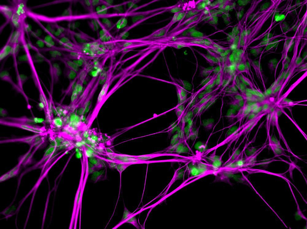 Пластическая клетка. Нейросфера. Нейронный сканер. Neural Stem Cell. Стволовые клетки морского укропа.