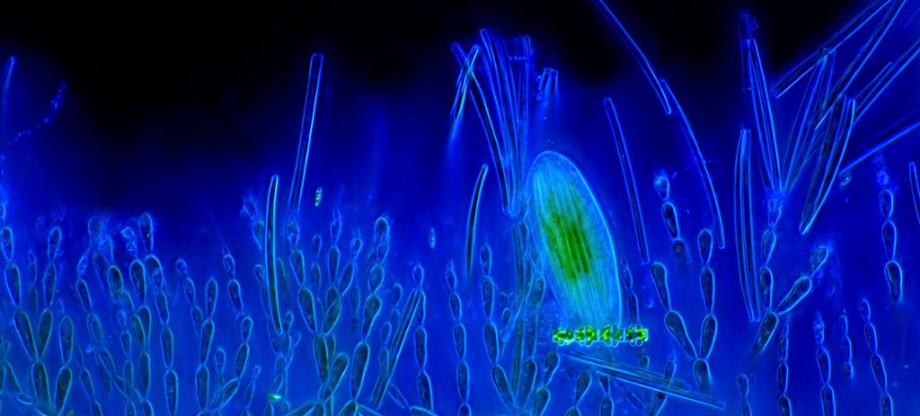 Mikroskopbilde av planteplankton. Foto.