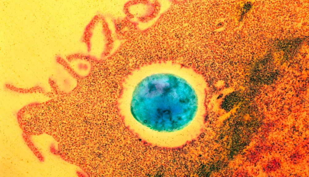 Mikroskopbilde av makrofag som omslutter en bakterie. Foto.