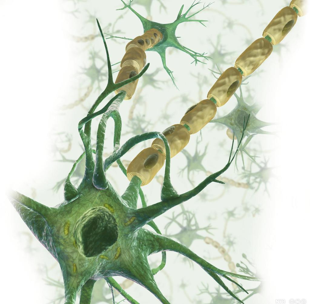 Illustrasjon av nervecelle med kjerne, lange og korte utløparar. Aksonet har myelinskjede.