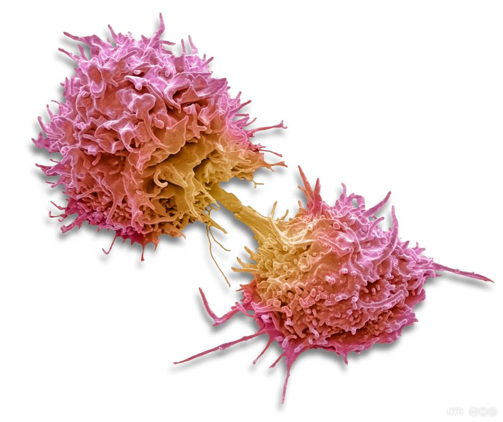 T-lymfocytt som er i ferd med å fullføre ei celledeling. Mikroskopfoto.