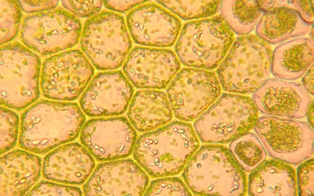 Mikroskopbilde som viser cellevegger og kloroplaster i en mosecelle. Foto.