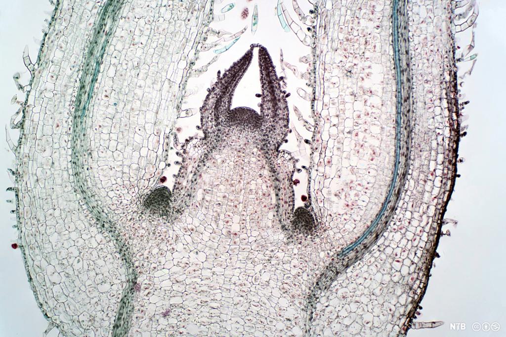 Lysmikroskopbilde av en planteknopp. Foto.
