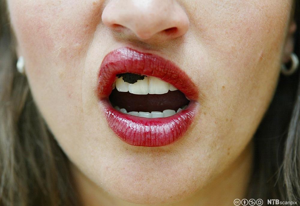 Nærbilde av munnen til en kvinne. Det er en stor snus under overleppa. Foto.