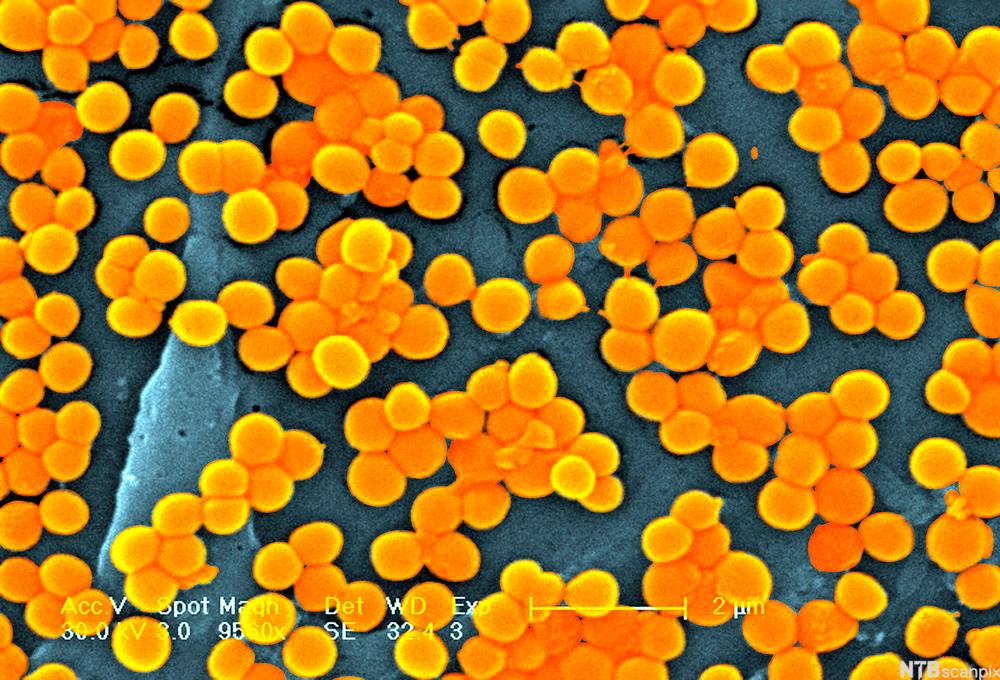 Oransje bakteriekolonier. Mikroskopfoto.