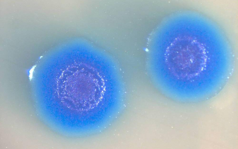 To blå og sirkulære bakterier. Foto.