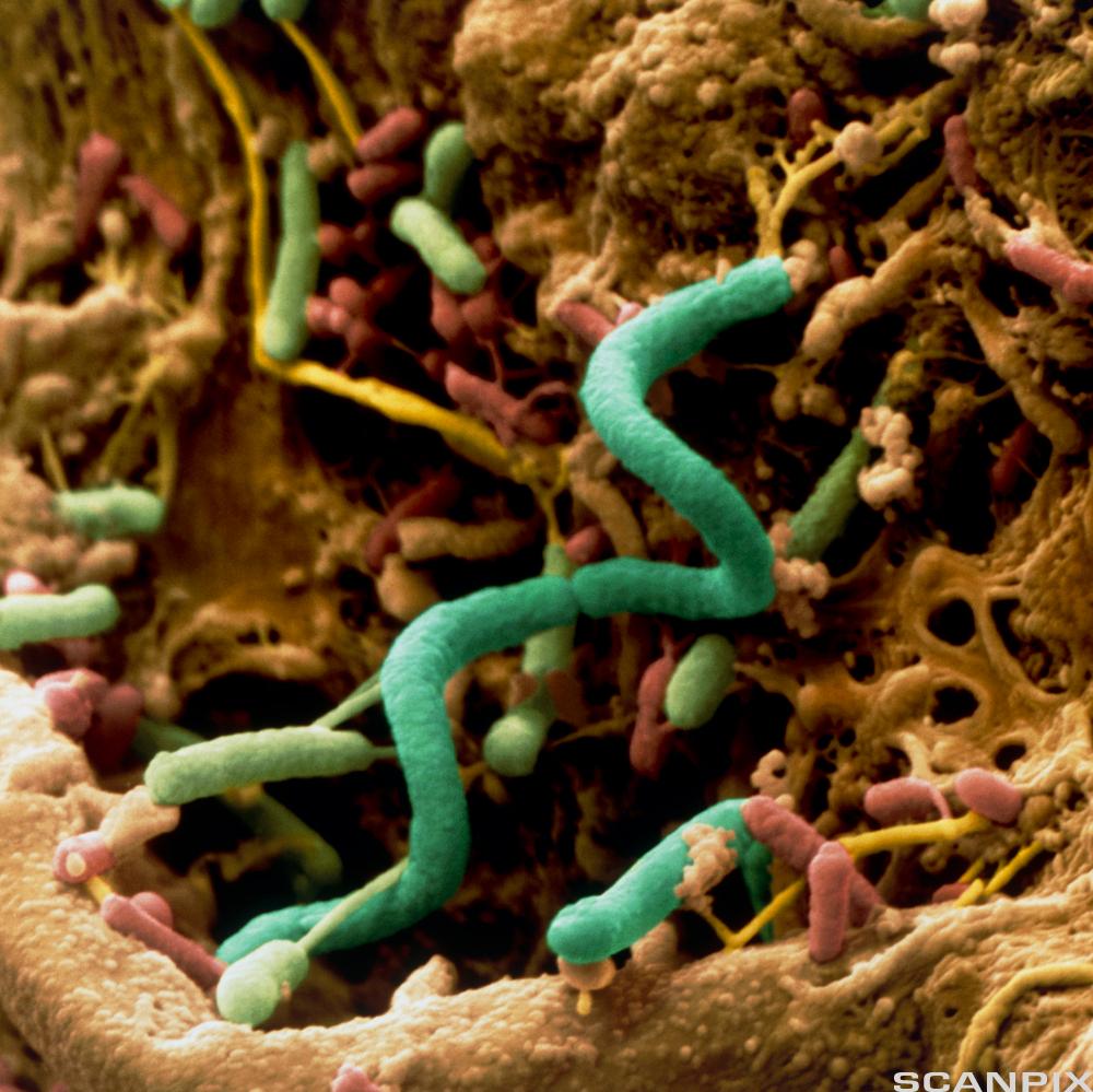 Grønne, slangeformede bakterier oppå brun/rødlig struktur. Foto.