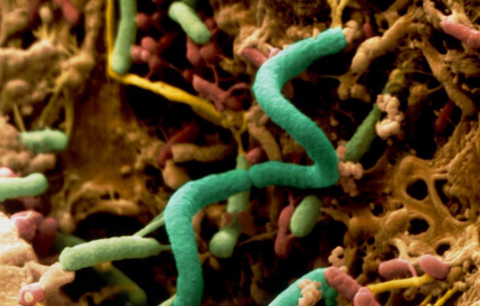 Mikroskopbilete av bakteriar. Foto.