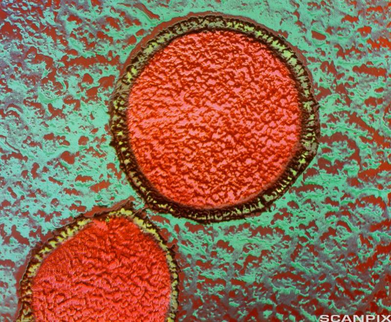To runde bakterier. Bildet er tatt gjennom et elektronmikroskop. 