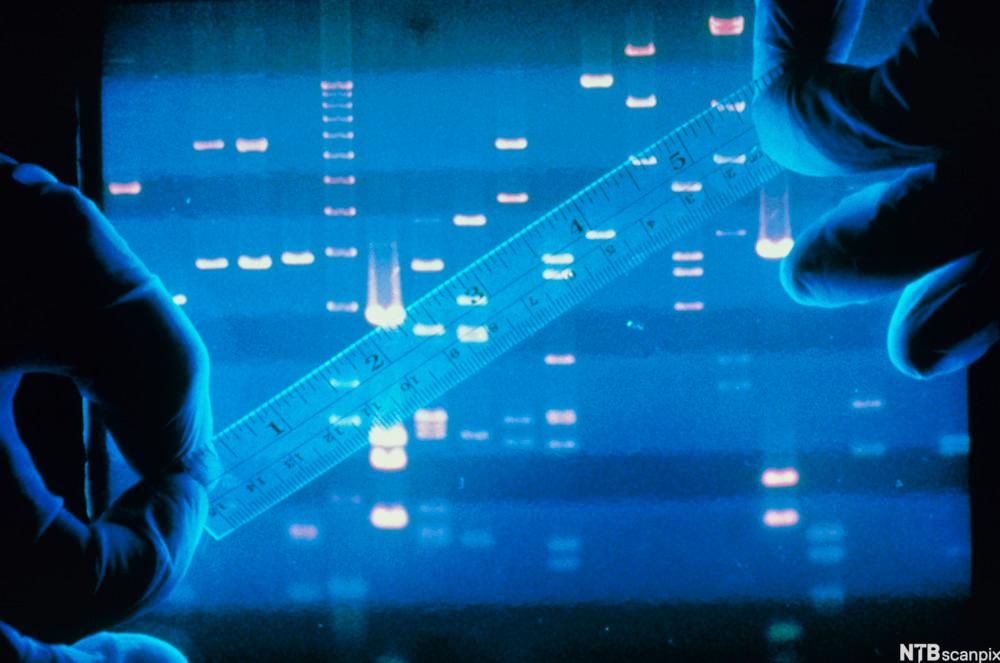 Hender med gummihansker foran et DNA-fingeravtrykk. Foto.