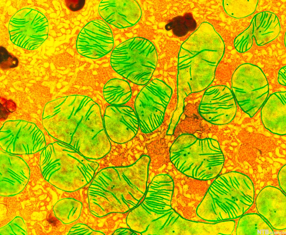 Farget mikroskopbilde som viser mitokondrier tett i tett og noen lysosomer i denne nyrecella. Illustrasjon.