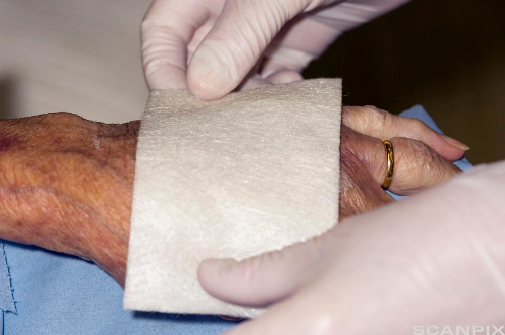Absorberende bandasje blir lagt på håndbaken til en eldre person. Foto.
