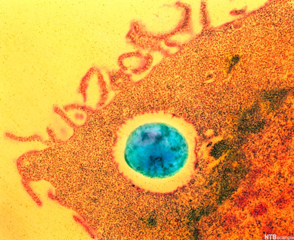 Mikroskopbilete av makrofag som omsluttar ein bakterie. Foto.