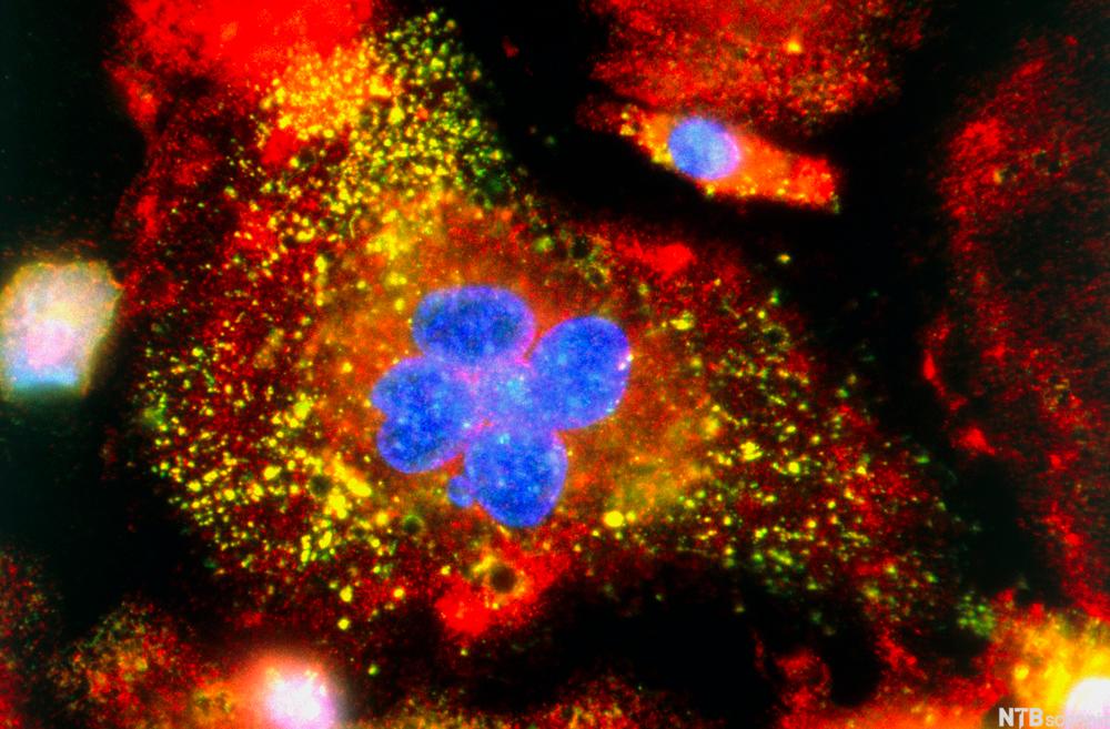 Immunofluorescent LM of active macrophages