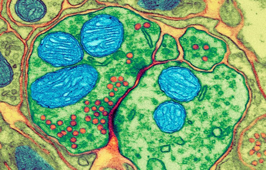 Ein synapse sett gjennom eit elektronmikroskop. Nervecellene er grøne, mitokondriane er blå, og signalstoffa er raude. Mikroskopfoto.