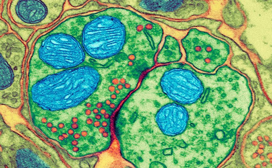 En synapse sett gjennom et elektronmikroskop. Nervecellene er grønne, mitokondriene er blå, og signalstoffene er røde. Mikroskopfoto.
