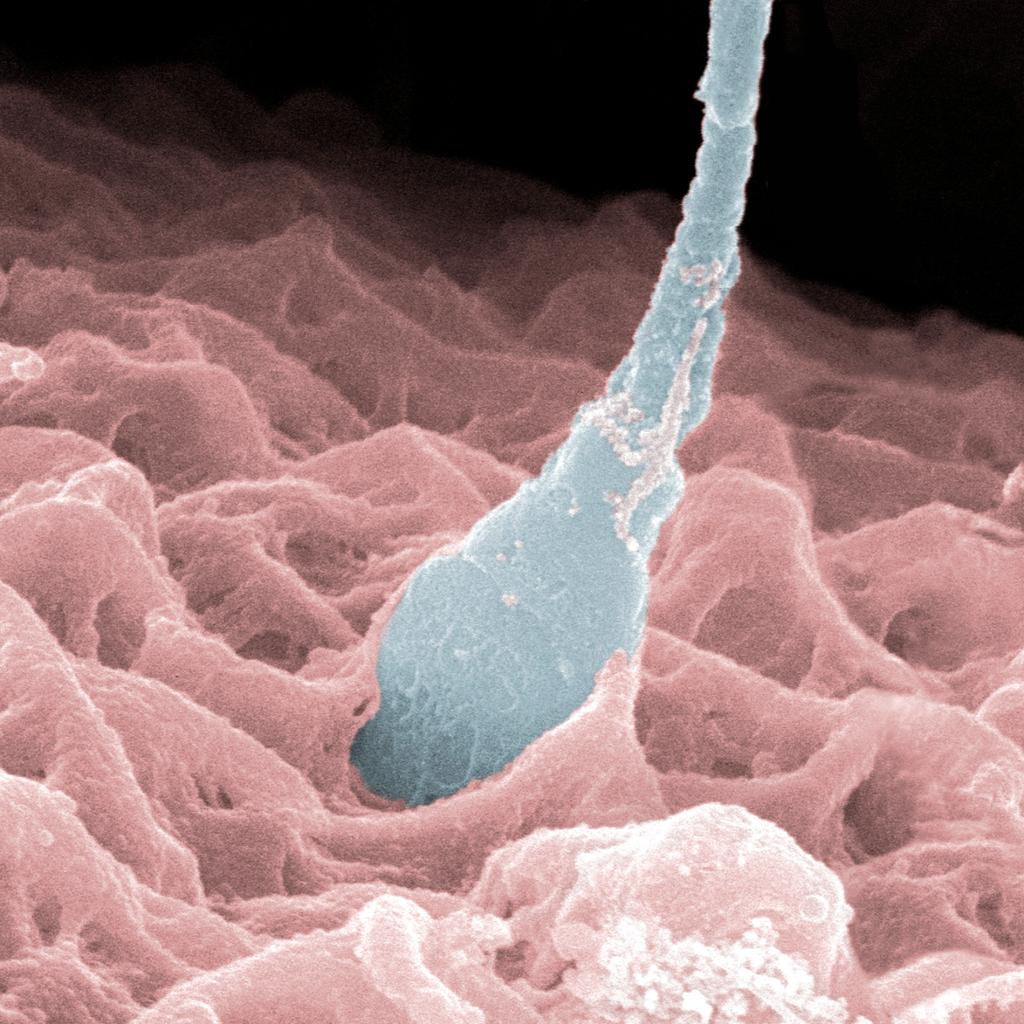 Mikroskopbilde av overflaten hos en eggcelle idet sædcellen trenger inn. Illustrasjon.