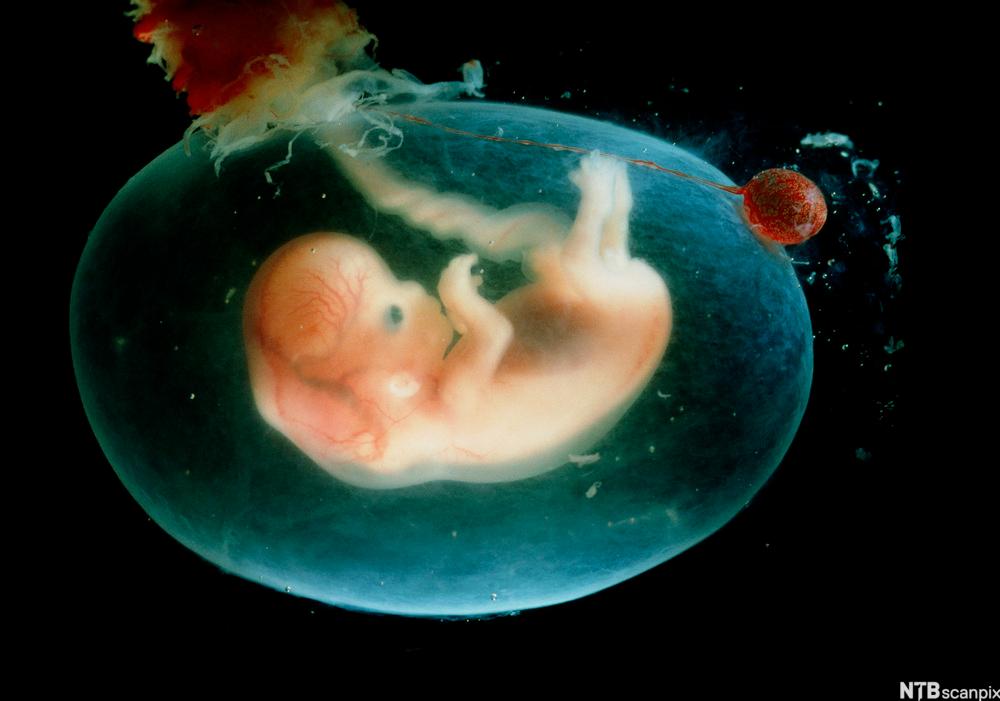 Embryo i fosterhinne. Vi kan også se navlestrengen og morkake. Foto. 