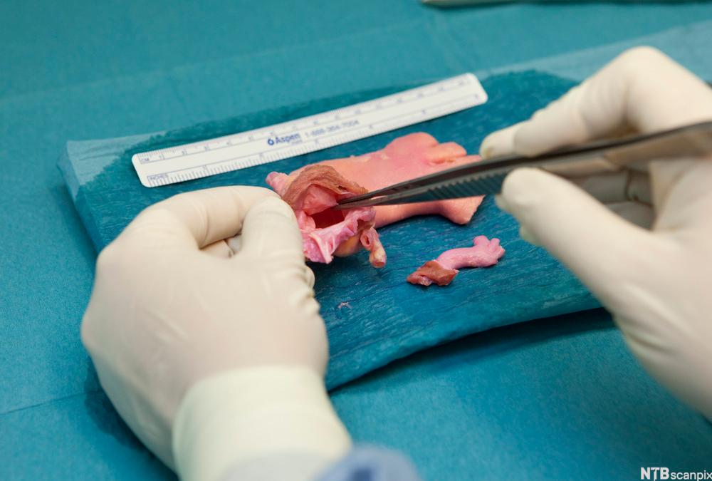 To hender som preparerer aorta med hjerteklaffer for transplantasjon. Foto.