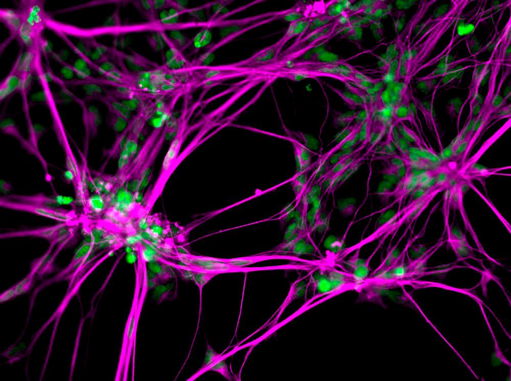 Mikroskopbilde av nerveceller. Foto.