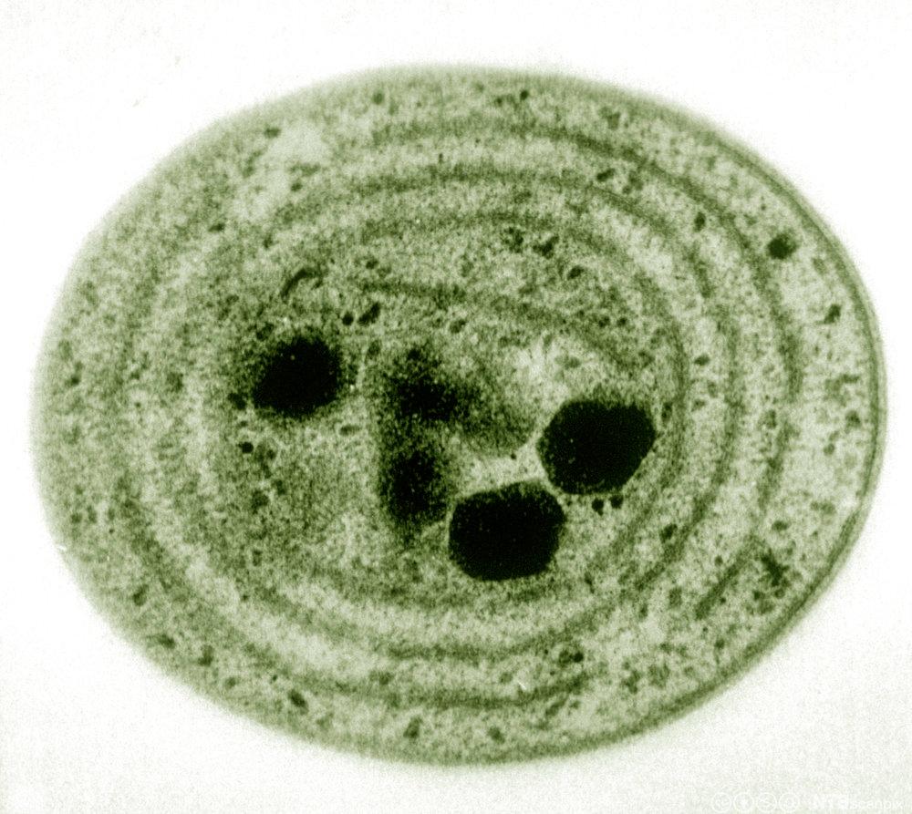 Grønn og rund bakterie med sterkt foldet cellemembran. Foto.
