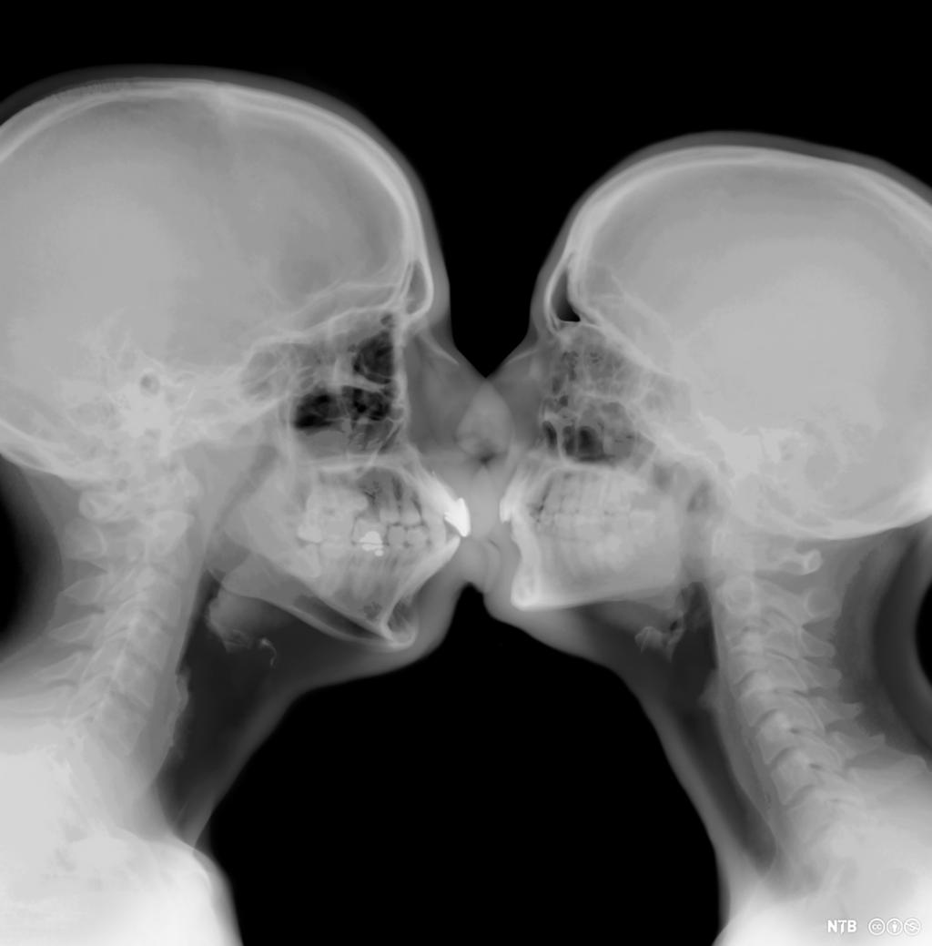 Røntgenbilde av to mennesker som kysser. Illustrasjon.