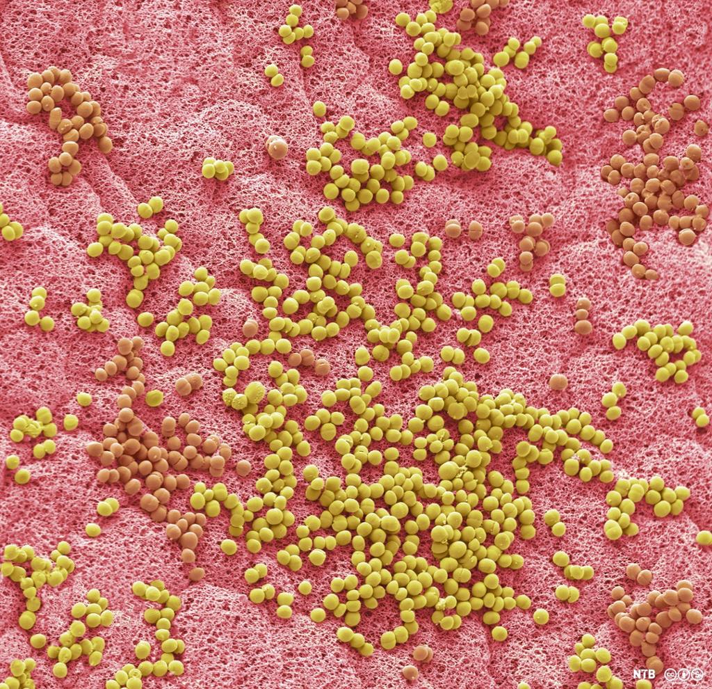 Bakterier i armhulen. Mikroskopfoto.