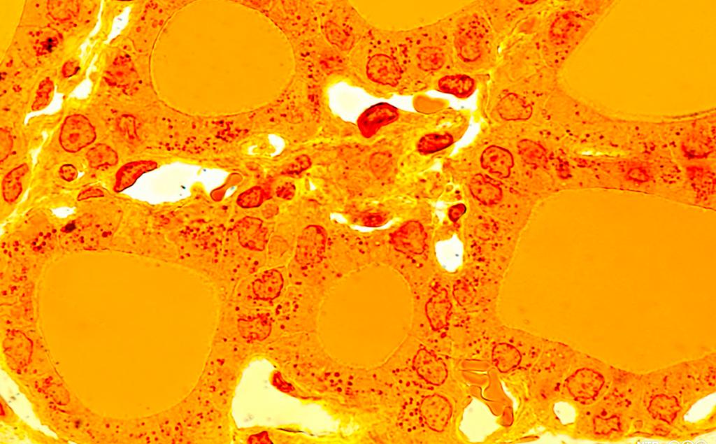 Lysmikroskopbilde fra skjoldbruskkjertel. Foto.