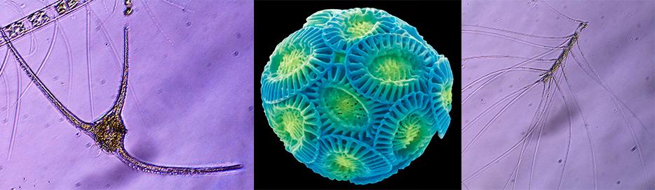 Tre bilder av planteplankton som er satt sammen. Foto.
