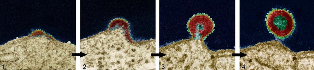 Et HIV-virus dukker opp og frigjøres fra en T-celle. Mikroskopbilde.