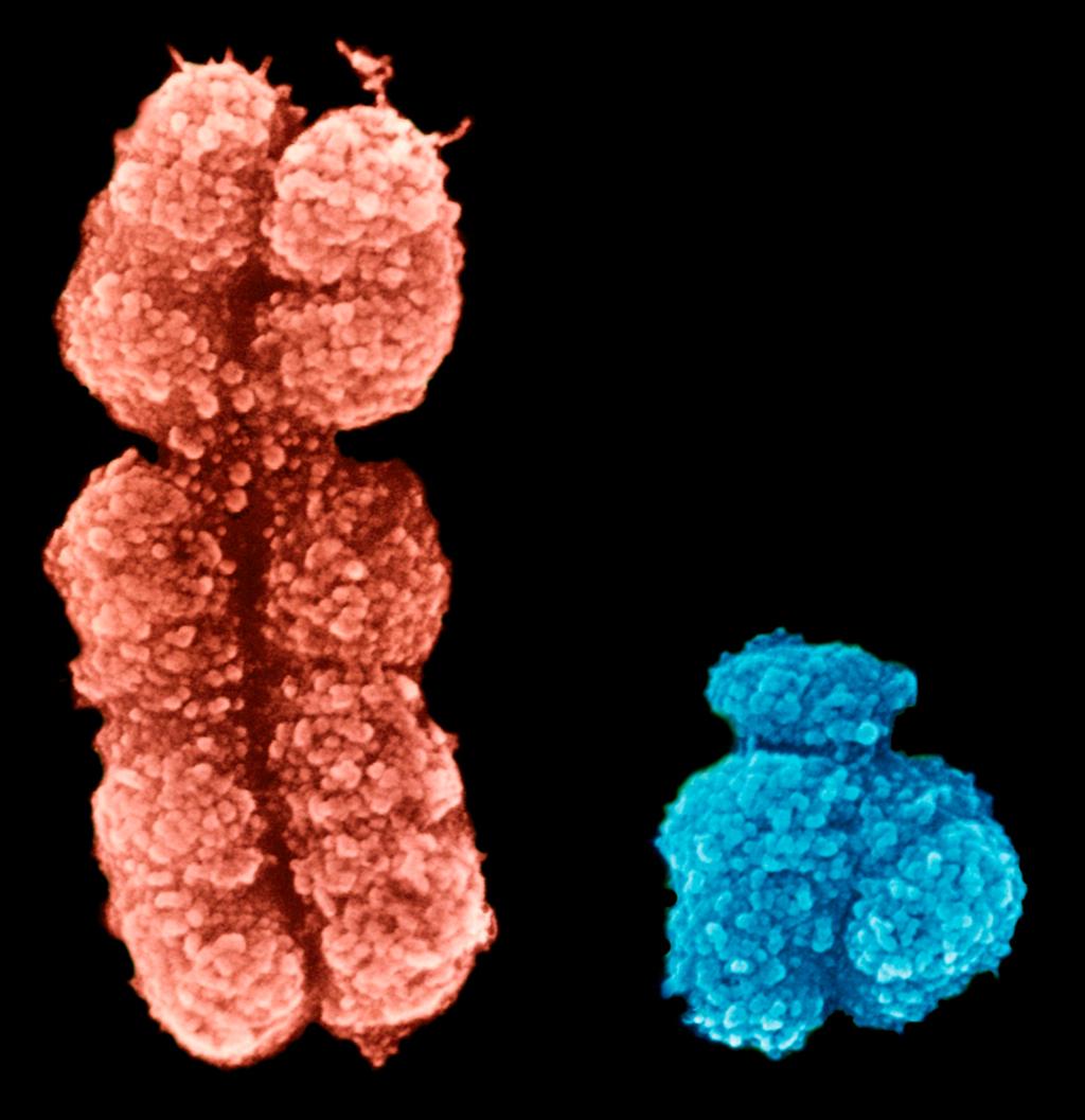Mikroskopbilde av stort X-kromosom og et mye mindre Y-kromosom- Foto.
